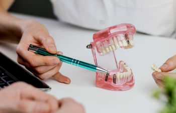 Dentist with a dental model explaining dental implants to a patient.